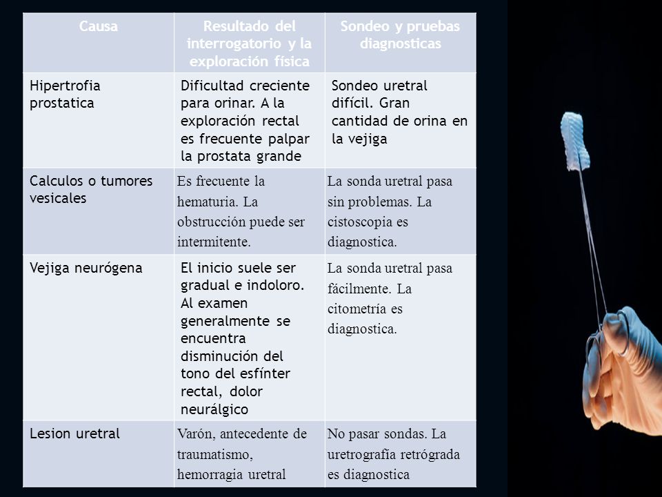 dificultad para orinar exámenes de prueba